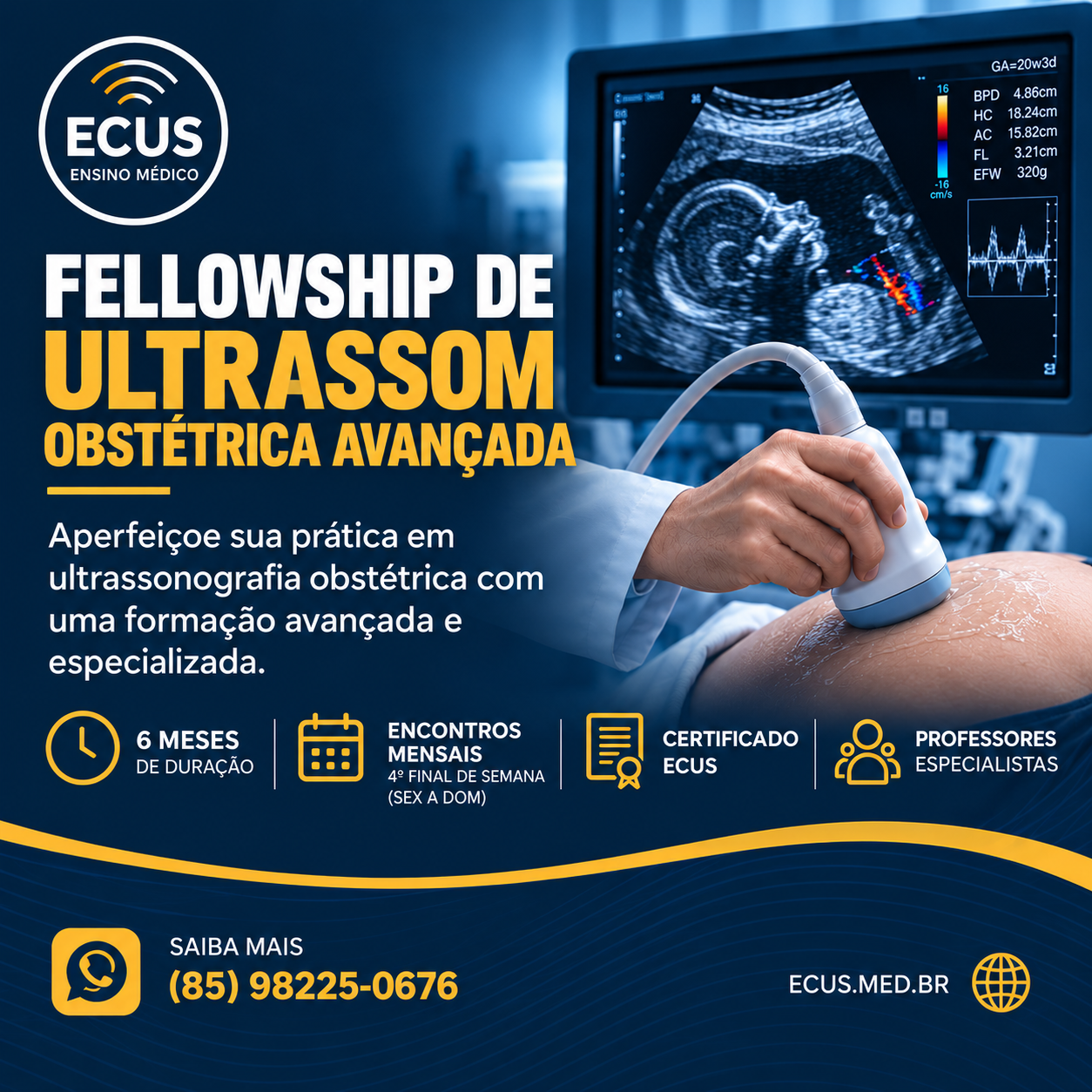 Formação Avançada em Ultrassonografia Obstétrica