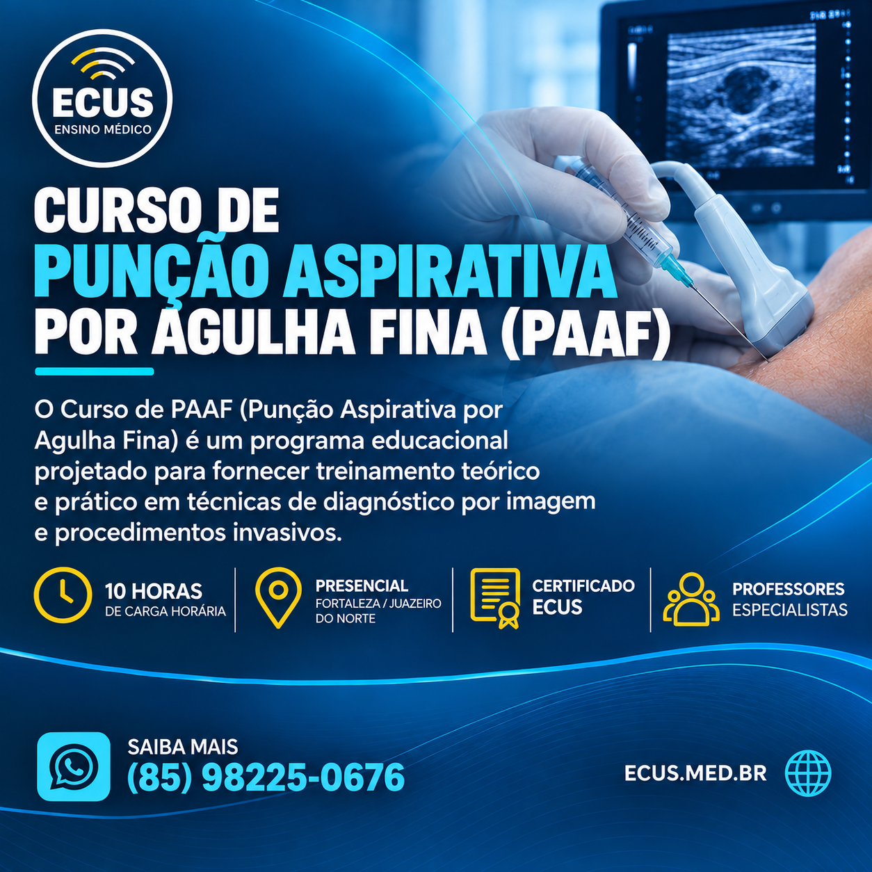 PAAF (Punção Aspirativa por Agulha Fina) de Tireoide